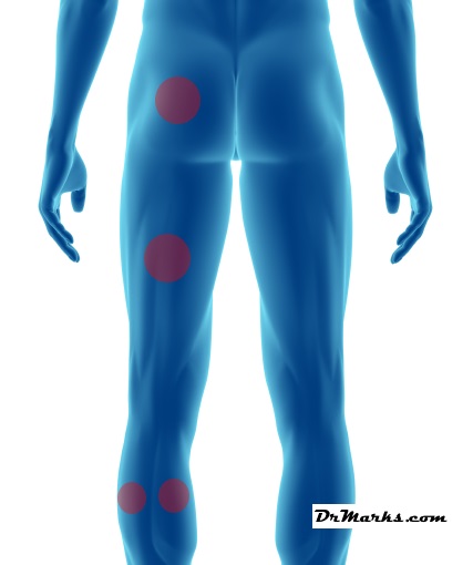 https://drmarks.com/wp-content/uploads/2019/03/sciatica-relief-pressure-points.jpg