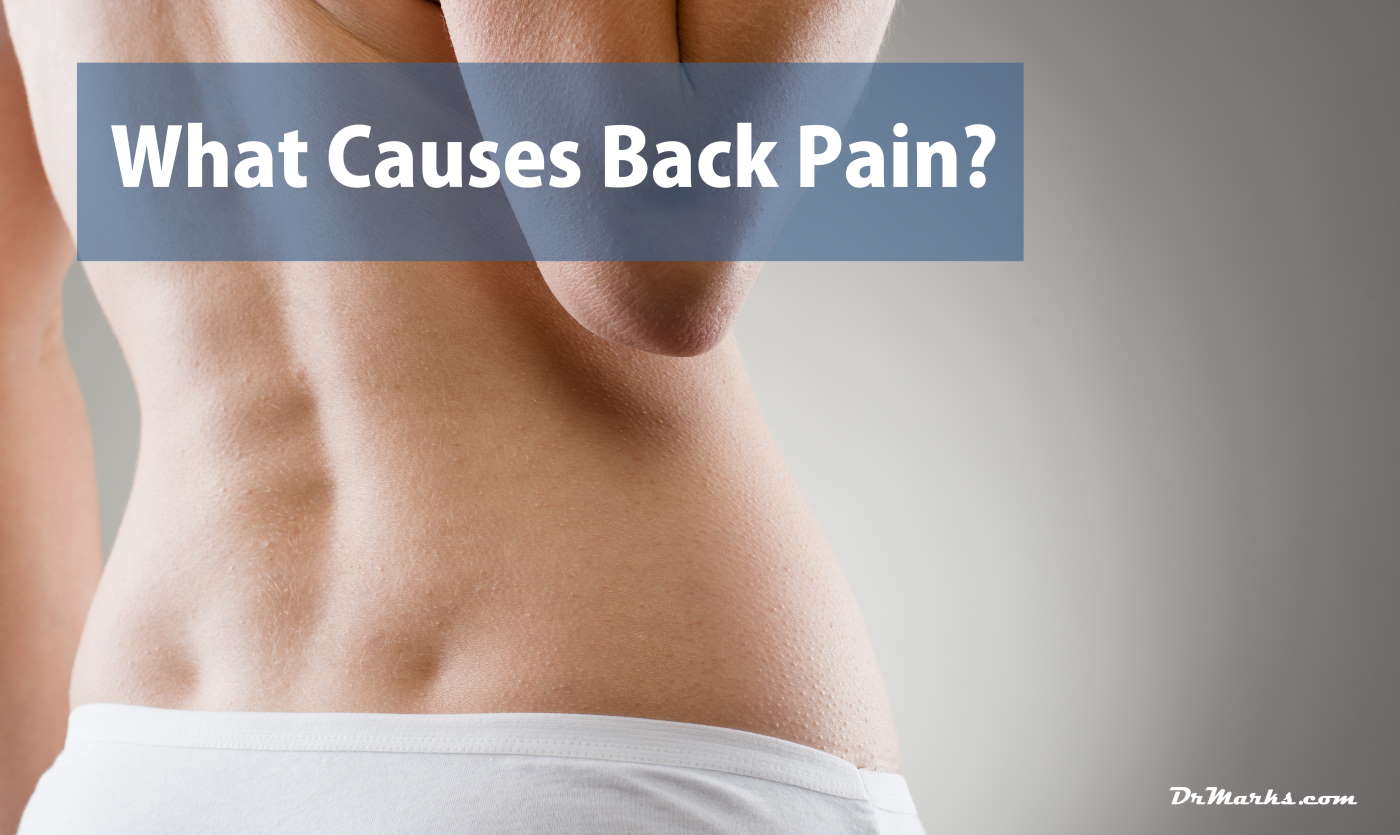 Causes of Back Pain Dr. Barry Marks Chiropractor